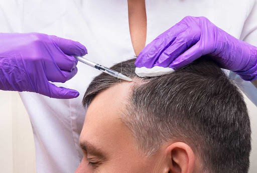 a person undergoing hair exoneme procedure