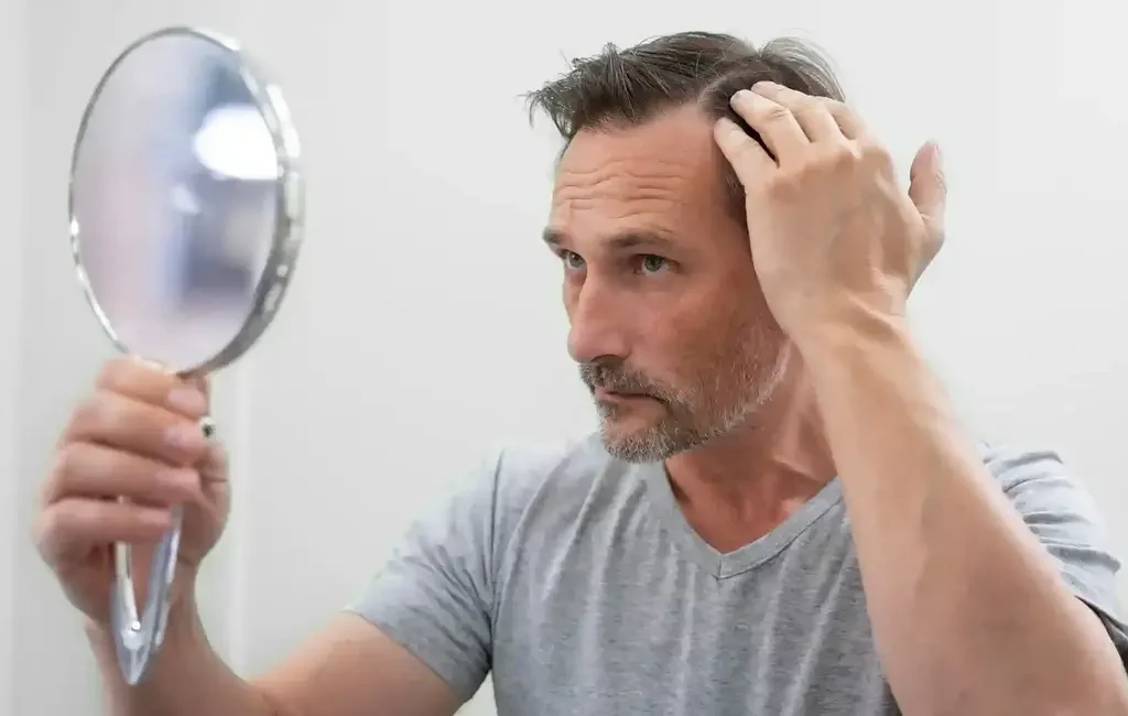 Man looking at the results after treatment for baldness