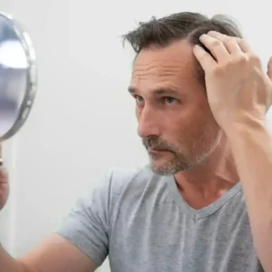 Man looking at the results after treatment for baldness